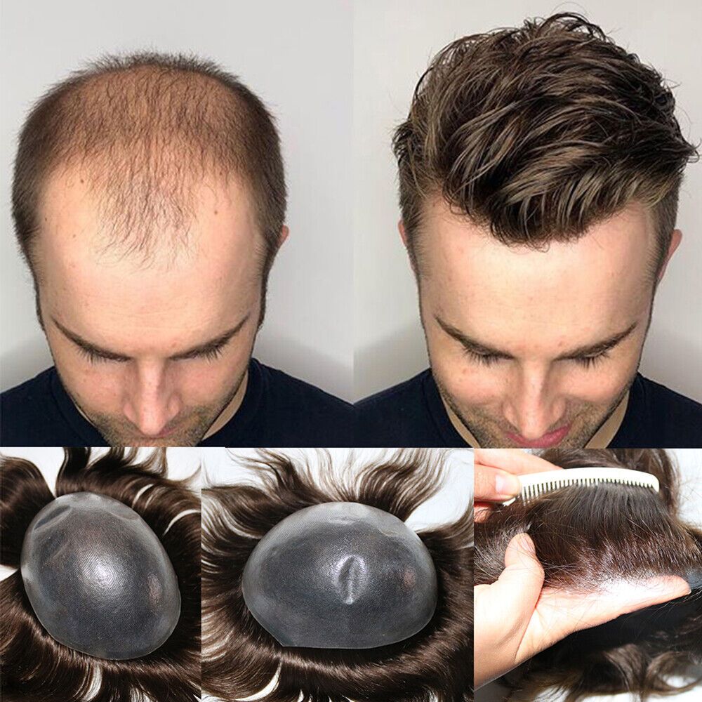 Mens hair systems - Natural Hair Direct for males